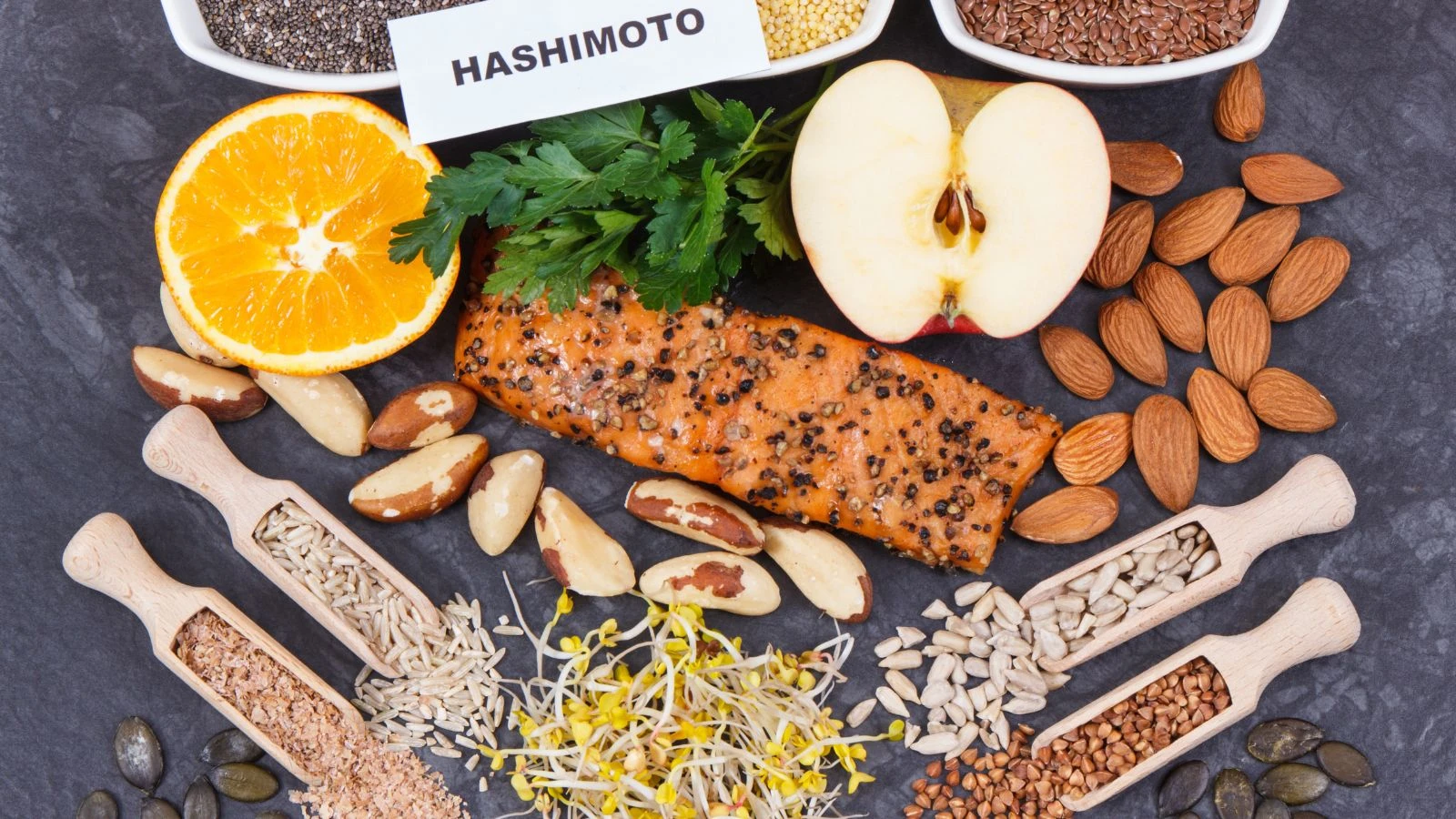 Hashimoto és babavállalás kezdőkép